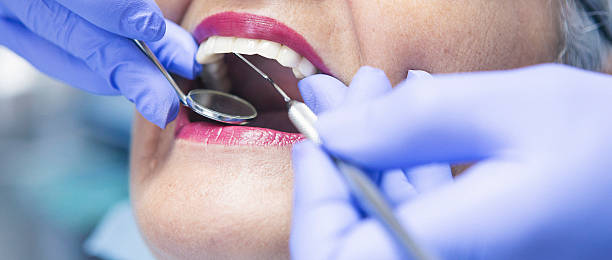 Best Emergency Dentist for Knocked-Out Tooth in Summerset, SD